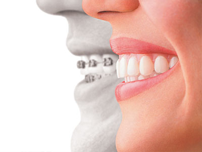 Ideal Dental Care