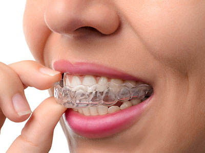 Ideal Dental Care