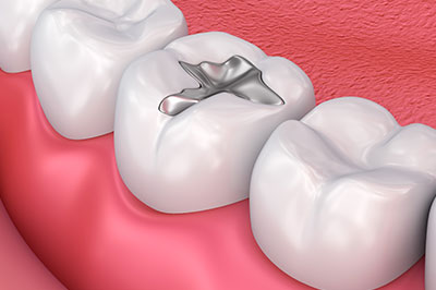 Ideal Dental Care