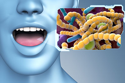 Ideal Dental Care