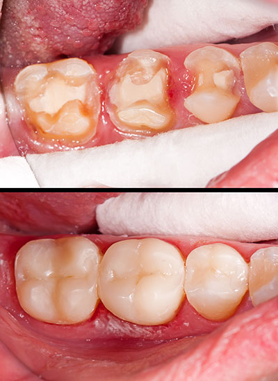 Ideal Dental Care