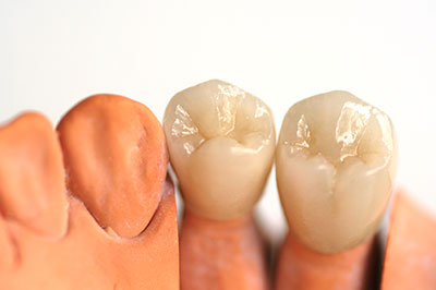 Ideal Dental Care