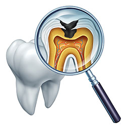 Ideal Dental Care