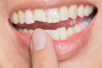 Ideal Dental Care