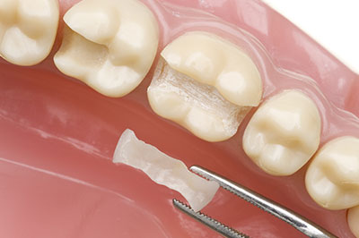 Ideal Dental Care