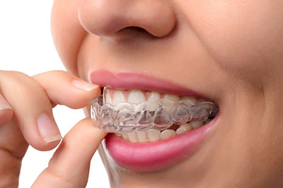 Ideal Dental Care