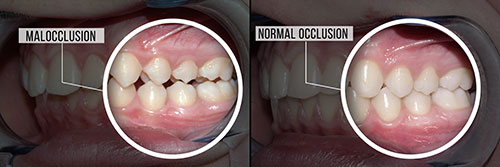 Ideal Dental Care