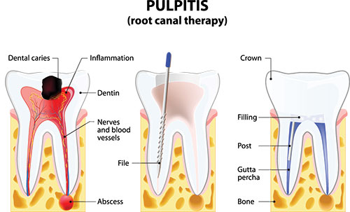 Ideal Dental Care