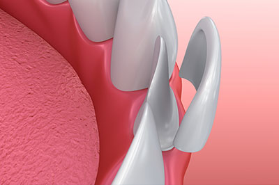 Ideal Dental Care